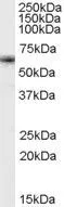 WB analysis of K562 cell lysate using GTX89101 FOXO4 antibody, Internal. Dilution : 1microg/ml Loading : 35microg protein in RIPA buffer