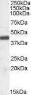 WB analysis of human tonsil lysate using GTX89104 ILF2 antibody,Internal. Dilution : 0.03ug/ml Loading : 35ug protein in RIPA buffer