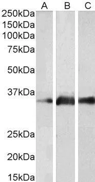 WB analysis of human brain (cerebellum) (A), mouse brain (B) and rat brain (C) lysates using GTX89113 Kallikrein 5 antibody, Internal. Dilution : 2microg/ml Loading : 35microg protein in RIPA buffer WB analysis of human brain (cerebellum) (A), mouse brain (B) and rat brain (C) lysates using GTX89113 Kallikrein 5 antibody, Internal. Dilution : 2microg/ml Loading : 35microg protein in RIPA buffer