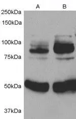 WB analysis of 1) rat aortic smooth muscle cell lysate 2) after infection with human APPL1 adenovirus using GTX89127 APPL1 antibody, Internal. Dilution : 0.5microg/ml WB analysis of 1) rat aortic smooth muscle cell lysate 2) after infection with human APPL1 adenovirus using GTX89127 APPL1 antibody, Internal. Dilution : 0.5microg/ml