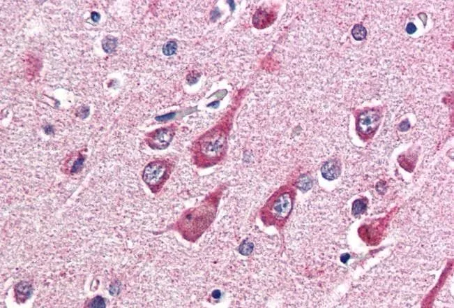 IHC-P analysis of human cortex using GTX89131 O-GlcNAc transferase antibody, Internal. Antigen retrieval : citrate buffer pH 6 Dilution : 5microg/ml IHC-P analysis of human cortex using GTX89131 O-GlcNAc transferase antibody, Internal. Antigen retrieval : citrate buffer pH 6 Dilution : 5microg/ml
