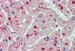 IHC-P analysis of human heart using GTX89133 ATGL antibody, Internal. Antigen retrieval : citrate buffer pH 6 Dilution : 2.5microg/ml