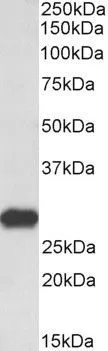 WB analysis of rat brain lysate using GTX89143 LXN antibody, C-term. Dilution : 0.3microg/ml Loading : 35microg protein in RIPA buffer WB analysis of rat brain lysate using GTX89143 LXN antibody, C-term. Dilution : 0.3microg/ml Loading : 35microg protein in RIPA buffer