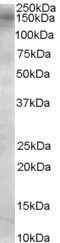 WB analysis of Daudi cell lysate using GTX89152 AS160 / TBC1D4 antibody, Internal. Dilution : 0.1microg/ml Loading : 35microg protein in RIPA buffer WB analysis of Daudi cell lysate using GTX89152 AS160 / TBC1D4 antibody, Internal. Dilution : 0.1microg/ml Loading : 35microg protein in RIPA buffer