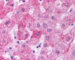 IHC-P analysis of human liver using GTX89155 Apolipoprotein M antibody, C-term. Antigen retrieval : citrate buffer pH 6 Dilution : 5microg/ml IHC-P analysis of human liver using GTX89155 Apolipoprotein M antibody, C-term. Antigen retrieval : citrate buffer pH 6 Dilution : 5microg/ml