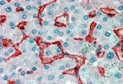 IHC-P analysis of human liver using GTX89161 VAP1 antibody, Internal. Antigen retrieval : citrate buffer pH 6 Dilution : 3.8microg/ml IHC-P analysis of human liver using GTX89161 VAP1 antibody, Internal. Antigen retrieval : citrate buffer pH 6 Dilution : 3.8microg/ml
