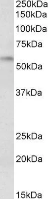 WB analysis of rat duodenum lysate using GTX89164 DGAT1 antibody, Internal. Dilution : 0.3microg/ml Loading : 35microg protein in RIPA buffer WB analysis of rat duodenum lysate using GTX89164 DGAT1 antibody, Internal. Dilution : 0.3microg/ml Loading : 35microg protein in RIPA buffer