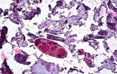 IHC-P analysis of human colon using GTX89164 DGAT1 antibody, Internal. Antigen retrieval : citrate buffer pH 6 Dilution : 3.75microg/ml