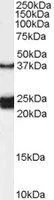 WB analysis of rat spinal cord lysate using GTX89167 GALR1 antibody,Internal. Dilution : 0.1ug/ml Loading : 35ug protein in RIPA buffer