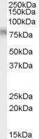 WB analysis of Daudi cell lysate using GTX89171 TCF3 / E2A antibody, Internal. Dilution : 0.01microg/ml Loading : 35microg protein in RIPA buffer