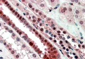 IHC-P analysis of human kidney using GTX89171 TCF3 / E2A antibody, Internal. Antigen retrieval : citrate buffer pH 6 Dilution : 3.8microg/ml