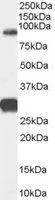 WB analysis of human brain (cerebellum) lysate using GTX89199 FOXP2 antibody, Internal. Dilution : 0.3microg/ml Loading : 35microg protein in RIPA buffer WB analysis of human brain (cerebellum) lysate using GTX89199 FOXP2 antibody, Internal. Dilution : 0.3microg/ml Loading : 35microg protein in RIPA buffer