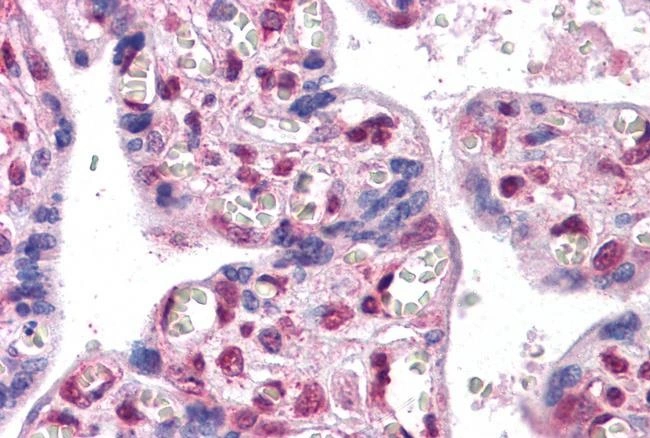 IHC-P analysis of paraffin embedded human placenta using GTX89199 FOXP2 antibody, Internal. Antigen retrieval : Steamed antigen retrieval with citrate buffer pH 6 Dilution : 2.5microg/ml