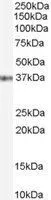 WB analysis of Jurkat cell lysate using GTX89212 GBX2 antibody, Internal. Dilution : 0.1microg/ml Loading : 35microg protein in RIPA buffer WB analysis of Jurkat cell lysate using GTX89212 GBX2 antibody, Internal. Dilution : 0.1microg/ml Loading : 35microg protein in RIPA buffer