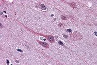 IHC-P analysis of human cortex using GTX89212 GBX2 antibody, Internal. Antigen retrieval : citrate buffer pH 6 Dilution : 3.75microg/ml