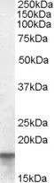 WB analysis of human colon lysate using GTX89217 Anterior Gradient 2 antibody, Internal. Dilution : 0.01microg/ml Loading : 35microg protein in RIPA buffer WB analysis of human colon lysate using GTX89217 Anterior Gradient 2 antibody, Internal. Dilution : 0.01microg/ml Loading : 35microg protein in RIPA buffer