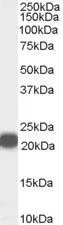WB analysis of human prostate lysate using GTX89220 RKIP antibody, Internal. Dilution : 0.01microg/ml Loading : 35microg protein in RIPA buffer WB analysis of human prostate lysate using GTX89220 RKIP antibody, Internal. Dilution : 0.01microg/ml Loading : 35microg protein in RIPA buffer