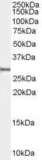 WB analysis of human HEK293 cell lysate using GTX89228 Syntenin 1 antibody, N-term. Dilution : 0.01microg/ml Loading : 35microg protein in RIPA buffer WB analysis of human HEK293 cell lysate using GTX89228 Syntenin 1 antibody, N-term. Dilution : 0.01microg/ml Loading : 35microg protein in RIPA buffer