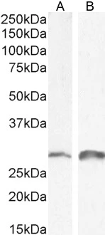 WB analysis of mouse (Lane A) and rat (Lane B) kidney lysate (35microg protein in RIPA buffer) using GTX89239 SNAI1 antibody, N-term. Dilution : 0.1microg/ml WB analysis of mouse (Lane A) and rat (Lane B) kidney lysate (35microg protein in RIPA buffer) using GTX89239 SNAI1 antibody, N-term. Dilution : 0.1microg/ml
