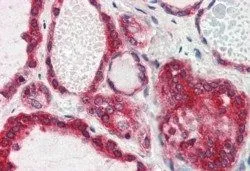 IHC-P analysis of human thyroid Gland using GTX89240 Lipin 3 antibody, Internal. Antigen retrieval : citrate buffer pH 6 Dilution : 2.5microg/ml IHC-P analysis of human thyroid Gland using GTX89240 Lipin 3 antibody, Internal. Antigen retrieval : citrate buffer pH 6 Dilution : 2.5microg/ml