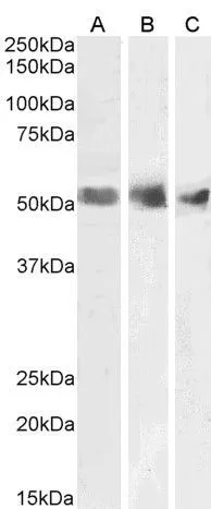 WB analysis of human spleen (A), kidney (B) and testis (C) lysates using GTX89257 Wilms Tumor 1 antibody, N-term. Dilution : 1microg/ml Loading : 35microg protein in RIPA buffer WB analysis of human spleen (A), kidney (B) and testis (C) lysates using GTX89257 Wilms Tumor 1 antibody, N-term. Dilution : 1microg/ml Loading : 35microg protein in RIPA buffer