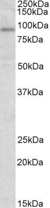 WB analysis of human heart lysate using GTX89276 STAT3 antibody, Internal. Dilution : 1microg/ml Loading : 35microg protein in RIPA buffer WB analysis of human heart lysate using GTX89276 STAT3 antibody, Internal. Dilution : 1microg/ml Loading : 35microg protein in RIPA buffer