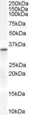 WB analysis of human heart lysate using GTX89279 VDAC2 antibody, Internal. Dilution : 0.3microg/ml Loading : 35microg protein in RIPA buffer WB analysis of human heart lysate using GTX89279 VDAC2 antibody, Internal. Dilution : 0.3microg/ml Loading : 35microg protein in RIPA buffer