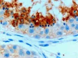 IHC-P analysis of human testis using GTX89281 GPX4 (Isoform a and c) antibody, C-term. Antigen retrieval : citrate buffer pH 6 Dilution : 0.3microg/ml