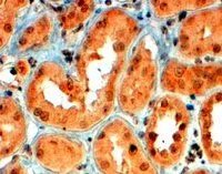 IHC-P analysis of human kidney using GTX89289 Semaphorin 5A antibody, Internal. Antigen retrieval : citrate buffer pH 6 Dilution : 4microg/ml IHC-P analysis of human kidney using GTX89289 Semaphorin 5A antibody, Internal. Antigen retrieval : citrate buffer pH 6 Dilution : 4microg/ml