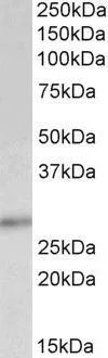 WB analysis of human breast lysate using GTX89293 p27 Kip1 antibody, C-term. Dilution : 0.5microg/ml Loading : 35microg protein in RIPA buffer WB analysis of human breast lysate using GTX89293 p27 Kip1 antibody, C-term. Dilution : 0.5microg/ml Loading : 35microg protein in RIPA buffer