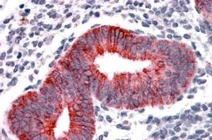 IHC-P analysis of human uterus using GTX89294 VPS29 antibody, Internal. Antigen retrieval : citrate buffer pH 6 Dilution : 3.8microg/ml IHC-P analysis of human uterus using GTX89294 VPS29 antibody, Internal. Antigen retrieval : citrate buffer pH 6 Dilution : 3.8microg/ml