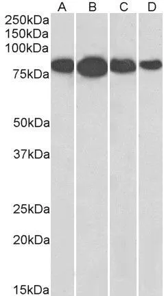WB analysis of NIH-3T3 (A), HeLa (B), Jurkat (C), and A431 (D) lysates using GTX89297 Radixin antibody, Internal. Dilution : 0.01microg/ml Loading : 35microg protein in RIPA buffer