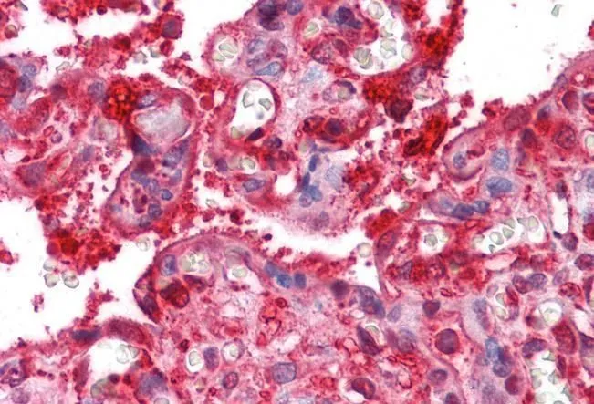 IHC-P analysis of human placenta using GTX89297 Radixin antibody, Internal. Antigen retrieval : citrate buffer pH 6 Dilution : 2.5microg/ml IHC-P analysis of human placenta using GTX89297 Radixin antibody, Internal. Antigen retrieval : citrate buffer pH 6 Dilution : 2.5microg/ml