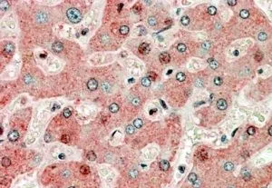 IHC-P analysis of human liver using GTX89299 GRP94 antibody, Internal. Antigen retrieval : citrate buffer pH 6 Dilution : 3.8microg/ml