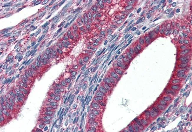 IHC-P analysis of human uterus using GTX89299 GRP94 antibody, Internal. Antigen retrieval : citrate buffer Ph 6 Dilution : 5microg/ml