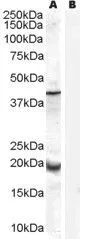 WB analysis of human prostate lysate with (B) and without (A) blocking with the immunising peptide using GTX89305 GPX7 antibody,Internal. Dilution : 0.3ug/ml Loading : 35ug protein in RIPA buffer
