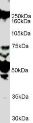 WB analysis of HUVEC lysate using GTX89308 ROBO1 antibody, Internal. Dilution : 1microg/ml Loading : 35microg protein in RIPA buffer WB analysis of HUVEC lysate using GTX89308 ROBO1 antibody, Internal. Dilution : 1microg/ml Loading : 35microg protein in RIPA buffer