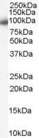 WB analysis of Daudi cell lysate using GTX89314 Importin beta 1 antibody, C-term. Dilution : 0.03microg/ml Loading : 35microg protein in RIPA buffer WB analysis of Daudi cell lysate using GTX89314 Importin beta 1 antibody, C-term. Dilution : 0.03microg/ml Loading : 35microg protein in RIPA buffer