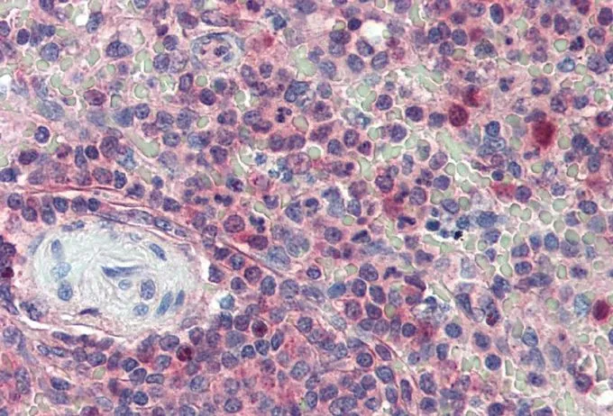 IHC-P analysis of human spleen using GTX89314 Importin beta 1 antibody, C-term. Antigen retrieval : citrate buffer pH 6 Dilution : 5microg/ml