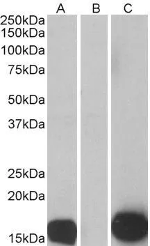 WB analysis of HEK293 overexpressing human Psoriasin with C-terminal MYC tag using GTX89325 Psoriasin antibody, Internal. Lane A : primary antibody Lane B : Mock-transfected HEK293 probed with primary antibody Lane C : Tag antibody Dilution : 0.5microg/ml Loading : 10microg protein in RIPA buffer