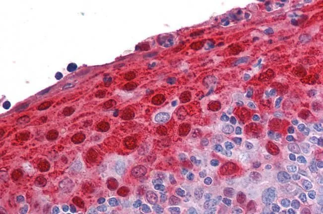 IHC-P analysis of human tonsil using GTX89325 Psoriasin antibody, Internal. Antigen retrieval : citrate buffer pH 6 Dilution : 3.75microg/ml