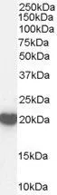 WB analysis of human brain lysate using GTX89331 PRX II antibody, C-term. Dilution : 1microg/ml Loading : 35microg protein in RIPA buffer WB analysis of human brain lysate using GTX89331 PRX II antibody, C-term. Dilution : 1microg/ml Loading : 35microg protein in RIPA buffer