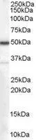 WB analysis of human kidney lysate using GTX89334 Chromogranin A precursor antibody, Internal. Dilution : 0.1microg/ml Loading : 35microg protein in RIPA buffer WB analysis of human kidney lysate using GTX89334 Chromogranin A precursor antibody, Internal. Dilution : 0.1microg/ml Loading : 35microg protein in RIPA buffer