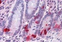 IHC-P analysis of human small intestine using GTX89334 Chromogranin A precursor antibody, Internal. Antigen retrieval : citrate buffer pH 6 Dilution : 3.75microg/ml