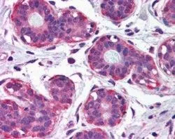 IHC-P analysis of human breast using GTX89335 NET1 antibody, Internal. Antigen retrieval : citrate buffer pH 6 Dilution : 2.5microg/ml IHC-P analysis of human breast using GTX89335 NET1 antibody, Internal. Antigen retrieval : citrate buffer pH 6 Dilution : 2.5microg/ml