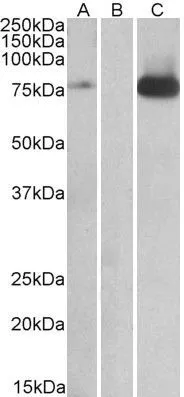 WB analysis of HEK293 overexpressing human TAK1 with DYKDDDDK tag using GTX89337 TAK1 antibody, Internal. Lane A : primary antibody Lane B : Mock-transfected HEK293 probed with primary antibody Lane C : Tag antibody Dilution : 1microg/ml Loading : 10microg protein in RIPA buffer WB analysis of HEK293 overexpressing human TAK1 with DYKDDDDK tag using GTX89337 TAK1 antibody, Internal. Lane A : primary antibody Lane B : Mock-transfected HEK293 probed with primary antibody Lane C : Tag antibody Dilution : 1microg/ml Loading : 10microg protein in RIPA buffer