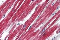 IHC-P analysis of human heart using GTX89338 Leptin Receptor antibody, Internal. Antigen retrieval : citrate buffer pH 6 Dilution : 4microg/ml