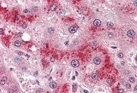 IHC-P analysis of human liver using GTX89338 Leptin Receptor antibody, Internal. Antigen retrieval : citrate buffer pH 6 Dilution : 4microg/ml