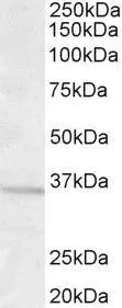 WB analysis of human brain (frontal cortex) lysate using GTX89343 GNB3 antibody, Internal. Dilution : 1microg/ml Loading : 35microg protein in RIPA buffer WB analysis of human brain (frontal cortex) lysate using GTX89343 GNB3 antibody, Internal. Dilution : 1microg/ml Loading : 35microg protein in RIPA buffer