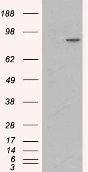 WB analysis of HEK293 overexpressing human alpha 1 Catenin (mock transfection in first lane) using GTX89347 alpha 1 Catenin antibody, Internal.